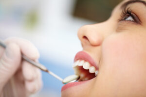 Wisdom-Tooth-Removal-for-Children-Under-18-300×200