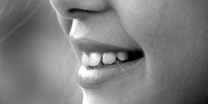 smile-mouth-teeth-laugh-65665 mouthguard