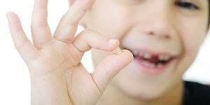 Dental-Exam-for-Kids San-Diego-Kids-Dental-Exams