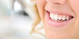 Healthy teeth, beautiful smile, young woman teeth