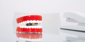 Chatter teeth on desk Wisdom teeth myths
