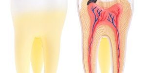 Tooth anatomy tooth decay
