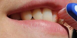 toothbrush-2696810_640 floride, dental health