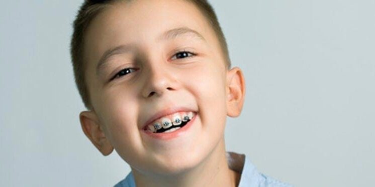 Braces for Kids – boy Braces for Kids