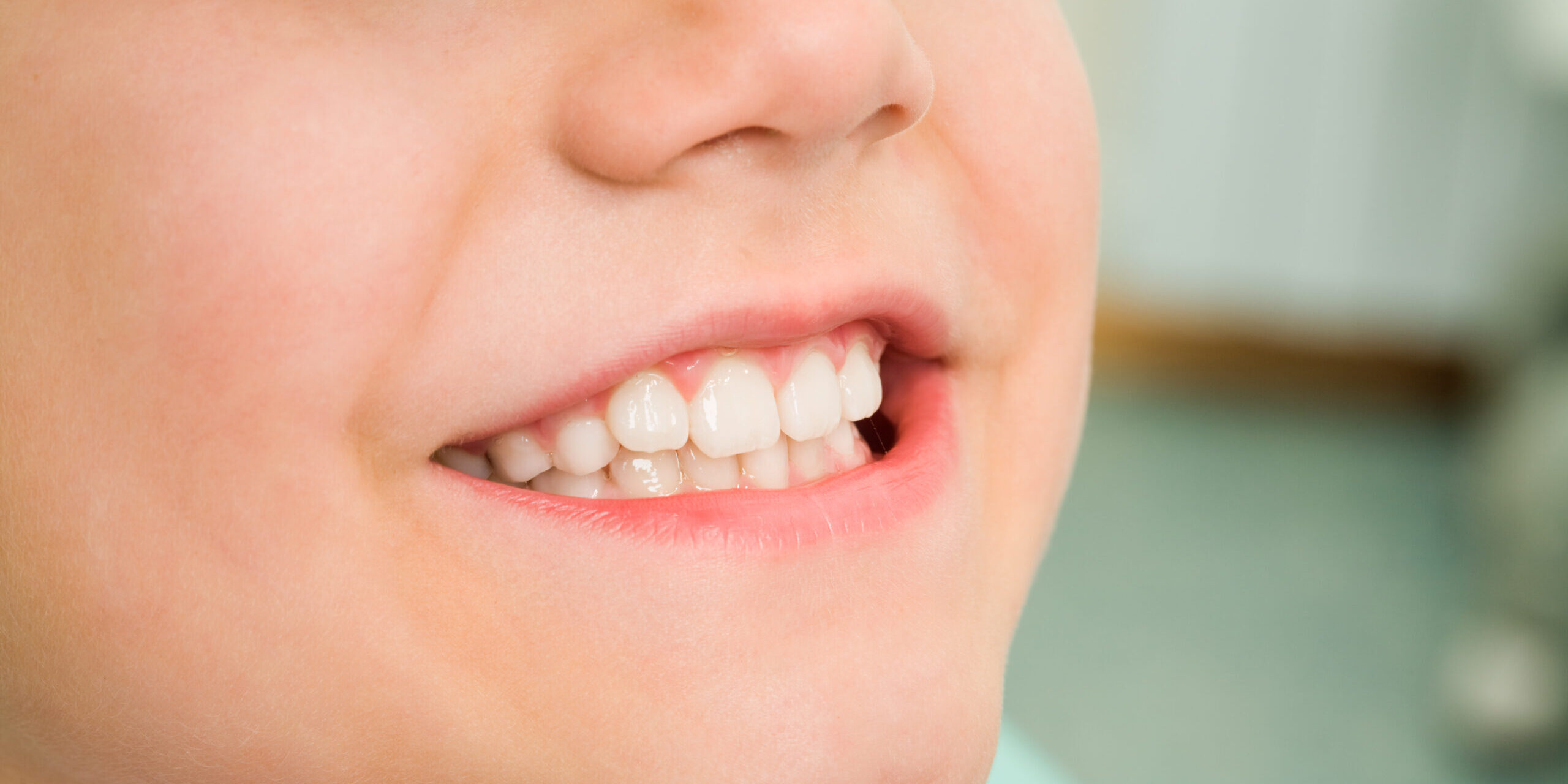 Pediatric Dentist in San Diego