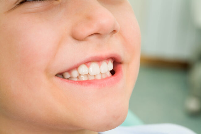 Pediatric Dentist in San Diego Pediatric Dentist in San Diego