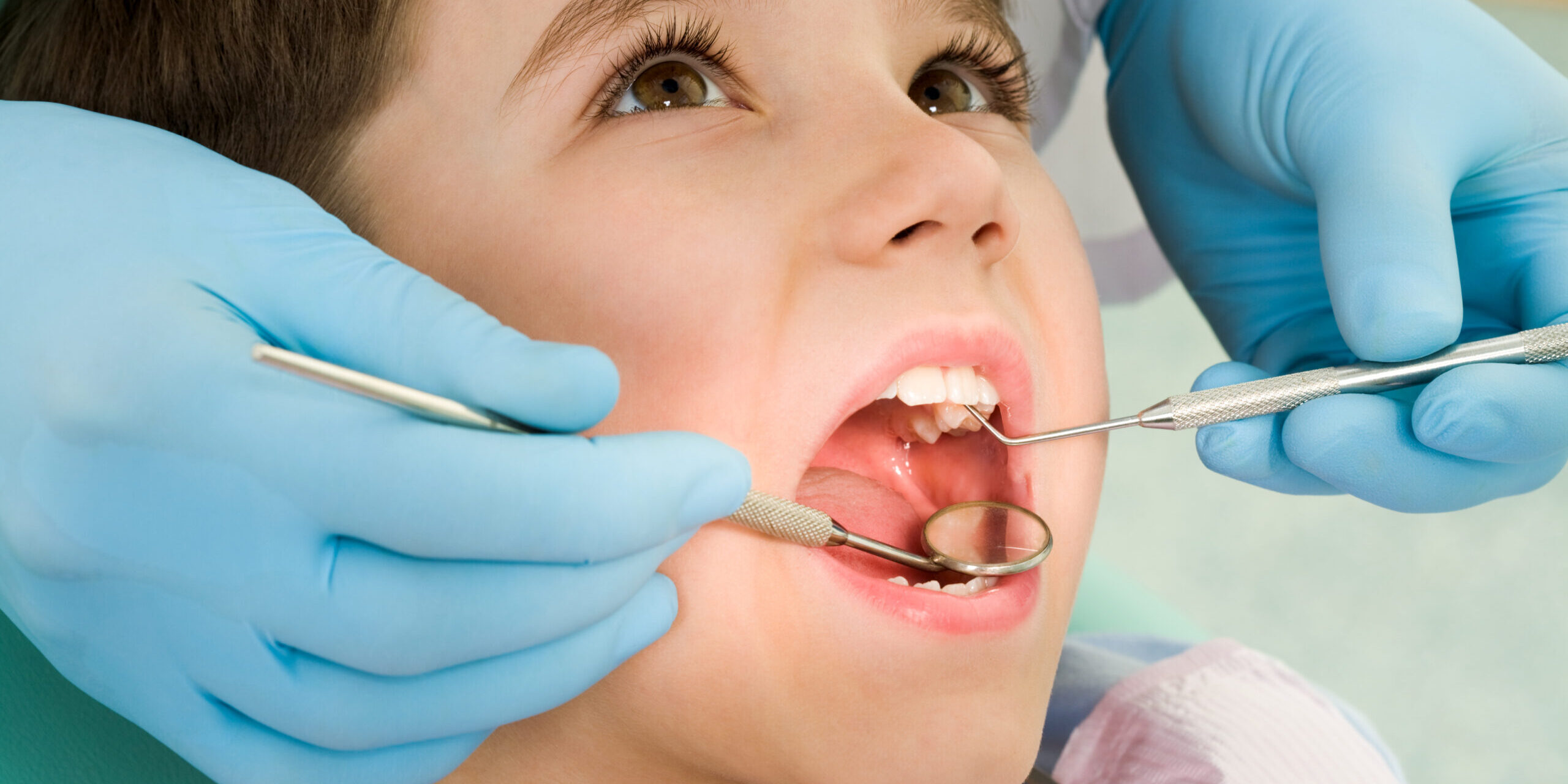 pediatric-dentist-in-san-diego
